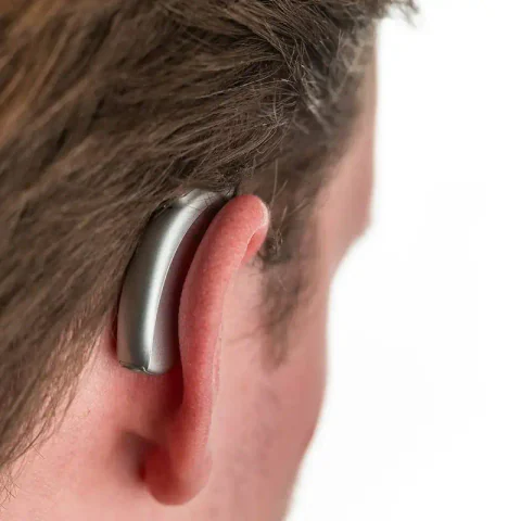 Phonak Naída em detalhe
